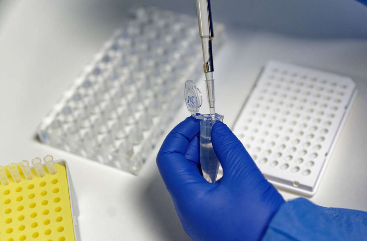 Coronavirus in Deutschland: Anspruch auf PCR-Nachtestung bei Positiv-Test könnte wegfallen