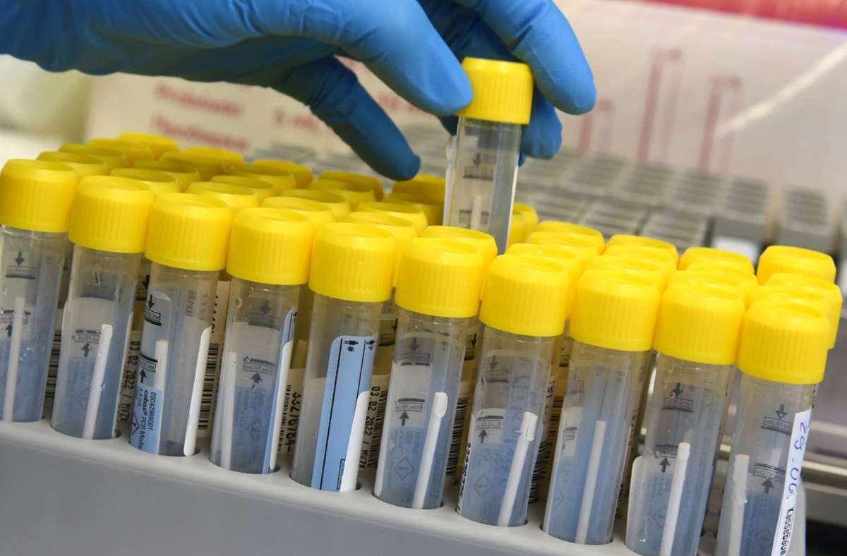 Coronavirus in Baden-Württemberg: Gesundheitsministerium rechnet  mit weniger Infektionen