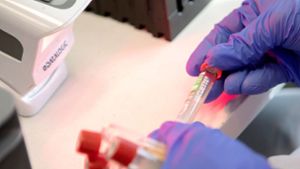 Land will mehr PCR-Tests in Apotheken