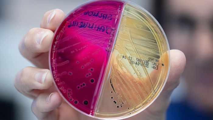 Medizin: Detektivarbeit am Darm-Mikrobiom: Was Stuhlproben verraten