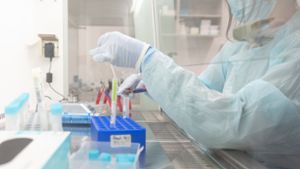Union fordert Priorisierung bei Auswertung von PCR-Tests