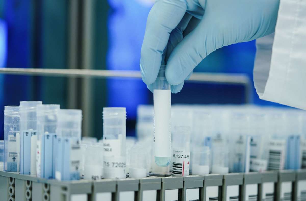 Omikron breitet sich so rasant aus, dass Labore nicht mehr alle PCR-Tests abarbeiten können. Foto: dpa/Uwe Anspach
